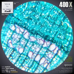 Tallo secundario: cambium